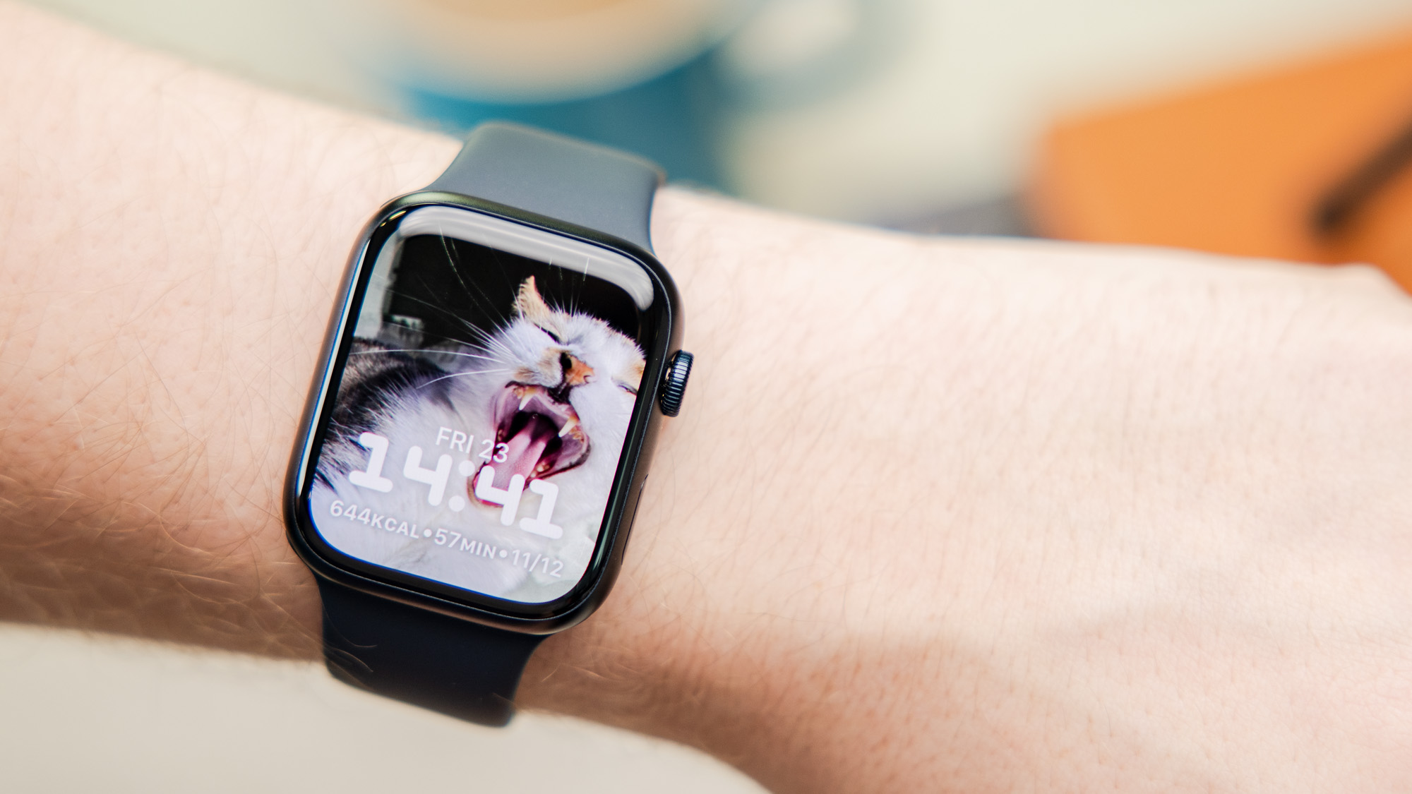 Apple Watch Series 10如何同步iCloud照片作为表盘_S10动态相册设置
